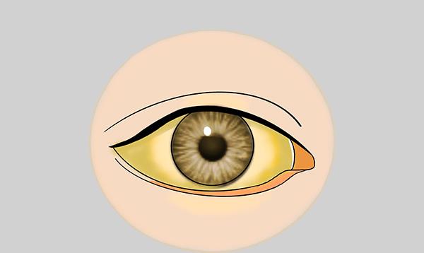 症状|肝脏变硬了，身体会“露出马脚”，晨起少做3事，肝脏更轻松