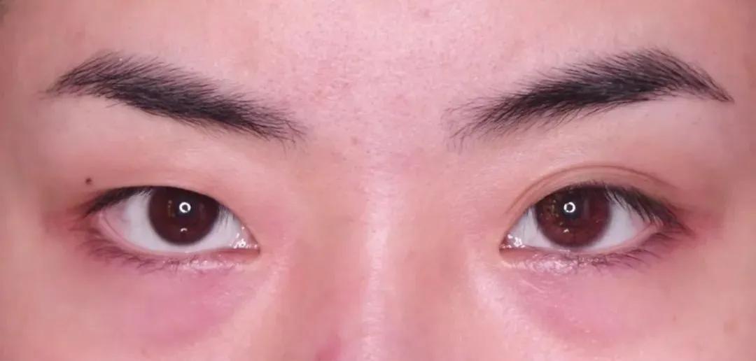眼睛为什么自己妆前妆后变化并不大，更有甚者，还变丑了？