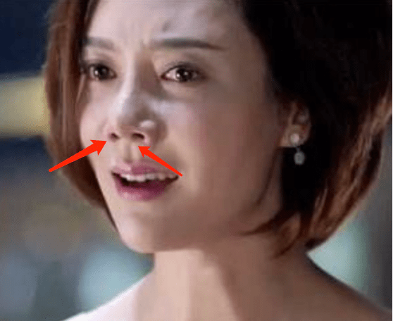 后遗症那些乱整鼻子的女星还好吗？后遗症一大堆，杨幂金晨都开始崩了