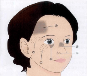 来例假打水光针怎么办