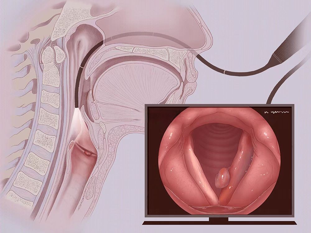躺下感觉喉咙有异物感想吐 a2f68370b7e543d1bf5e91fc0c01b66f.jpeg