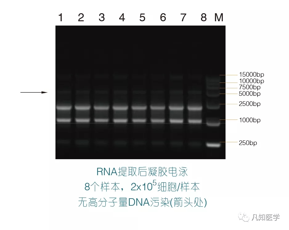 如何有效避免降解?提纯得到完整性好的动物细胞RNA_实验_样品_裂解