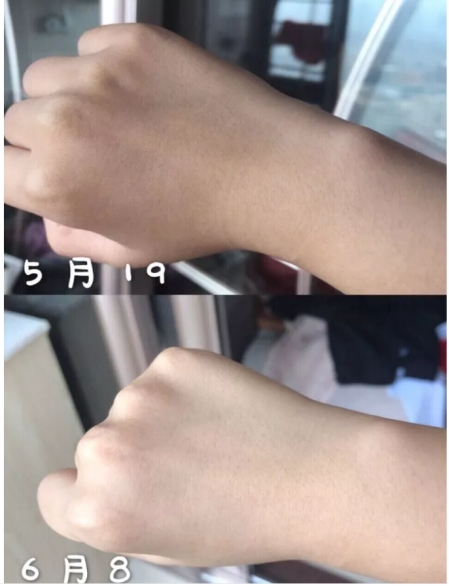 因为干货分享 如何让皮肤白得发光