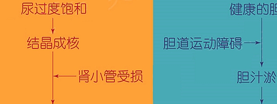 标准|得了肾结石真的要多喝水？喝多喝少主要是以这个为标准！