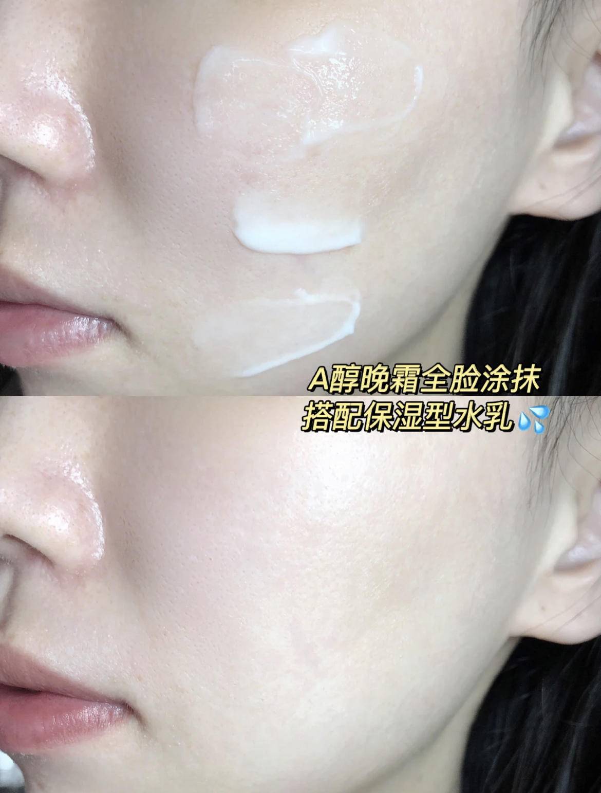 产品抗老要猛皮肤要稳！用A醇怎样才不翻车？