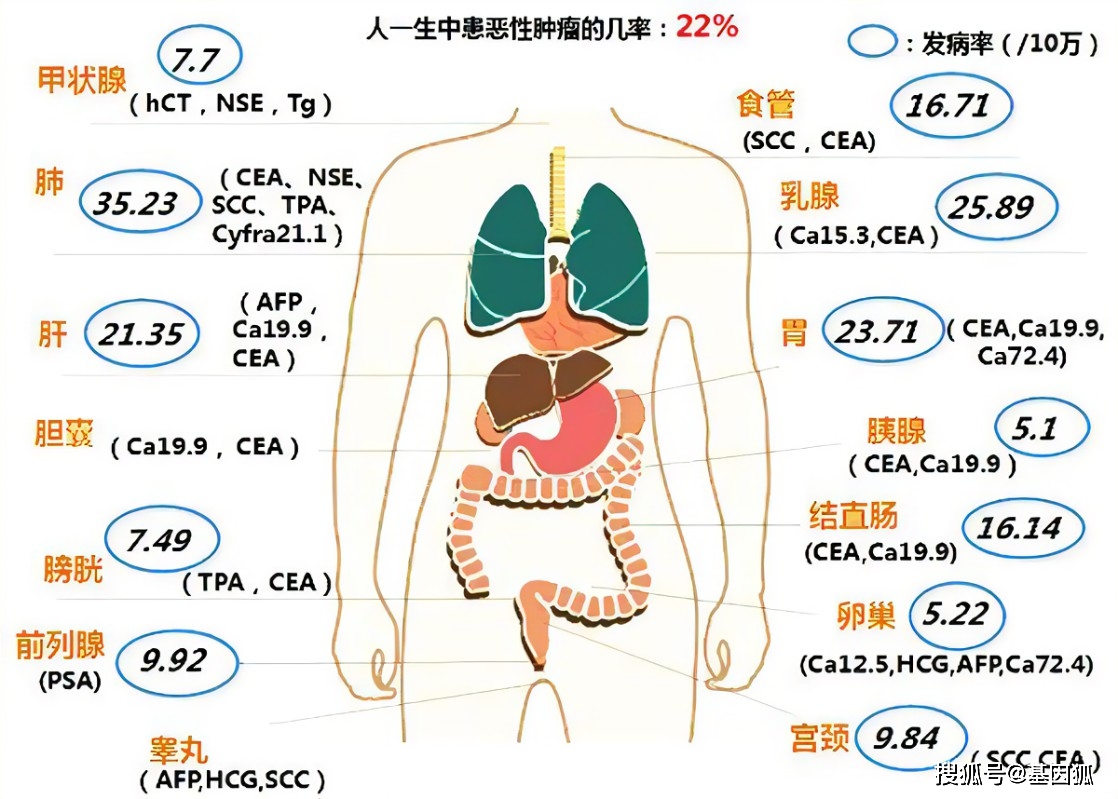 健康科普：12种常见肿瘤标志物简介_搜狐网