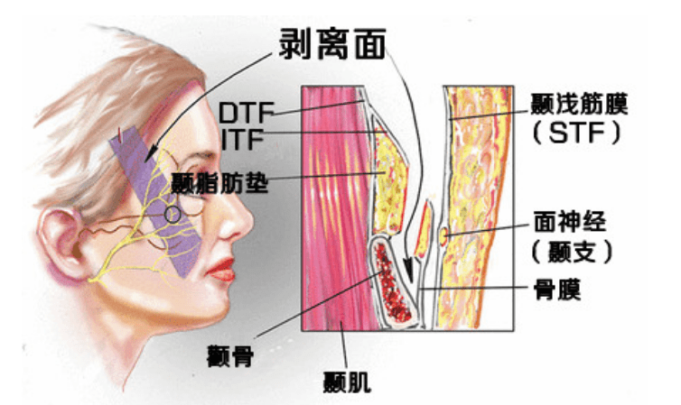进行涨知识：筋膜悬吊提眉效果可保持多久？筋膜提升术后注意事项谁知？