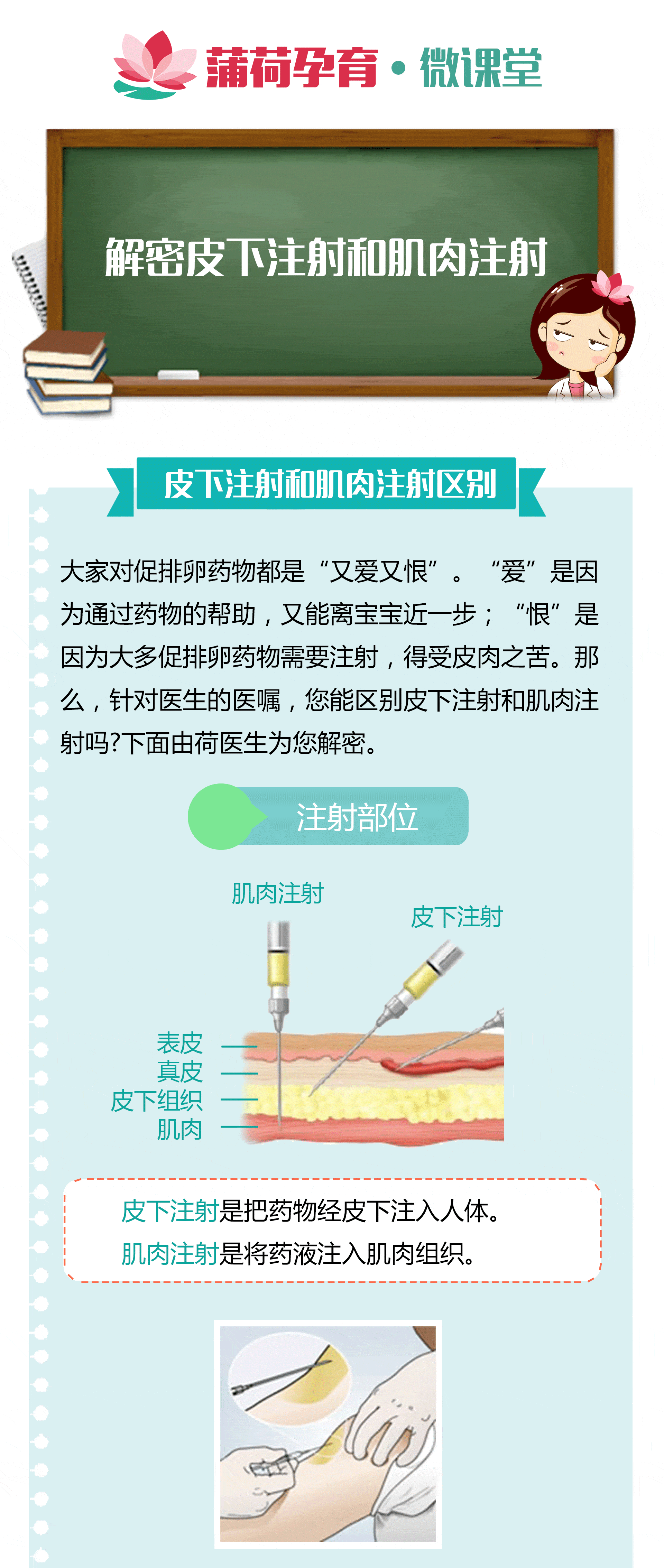 解密打促排針的皮下注射和肌肉注射