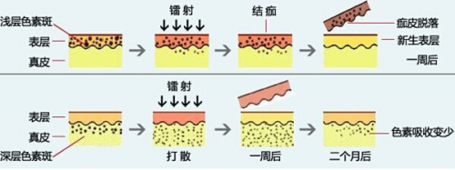 新生美白项目如何护理？“全阶倍护”带来沉浸式护肤体验！