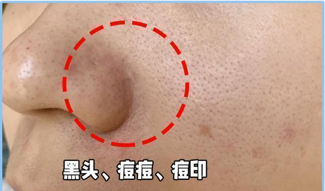 面部屈臣氏一“低调”爽肤水，包装简洁被轻视，用后效果不输知名大牌