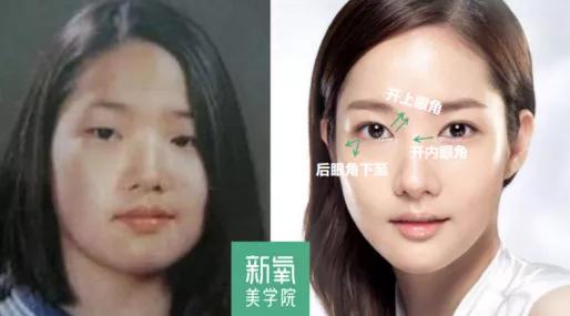 度数很多人都混淆了眯眯眼和小眼睛的区别