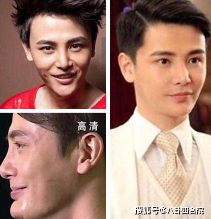 李小璐明星“假鼻子”大PK，帅哥变丑男，美女变女巫，谁越整越残？