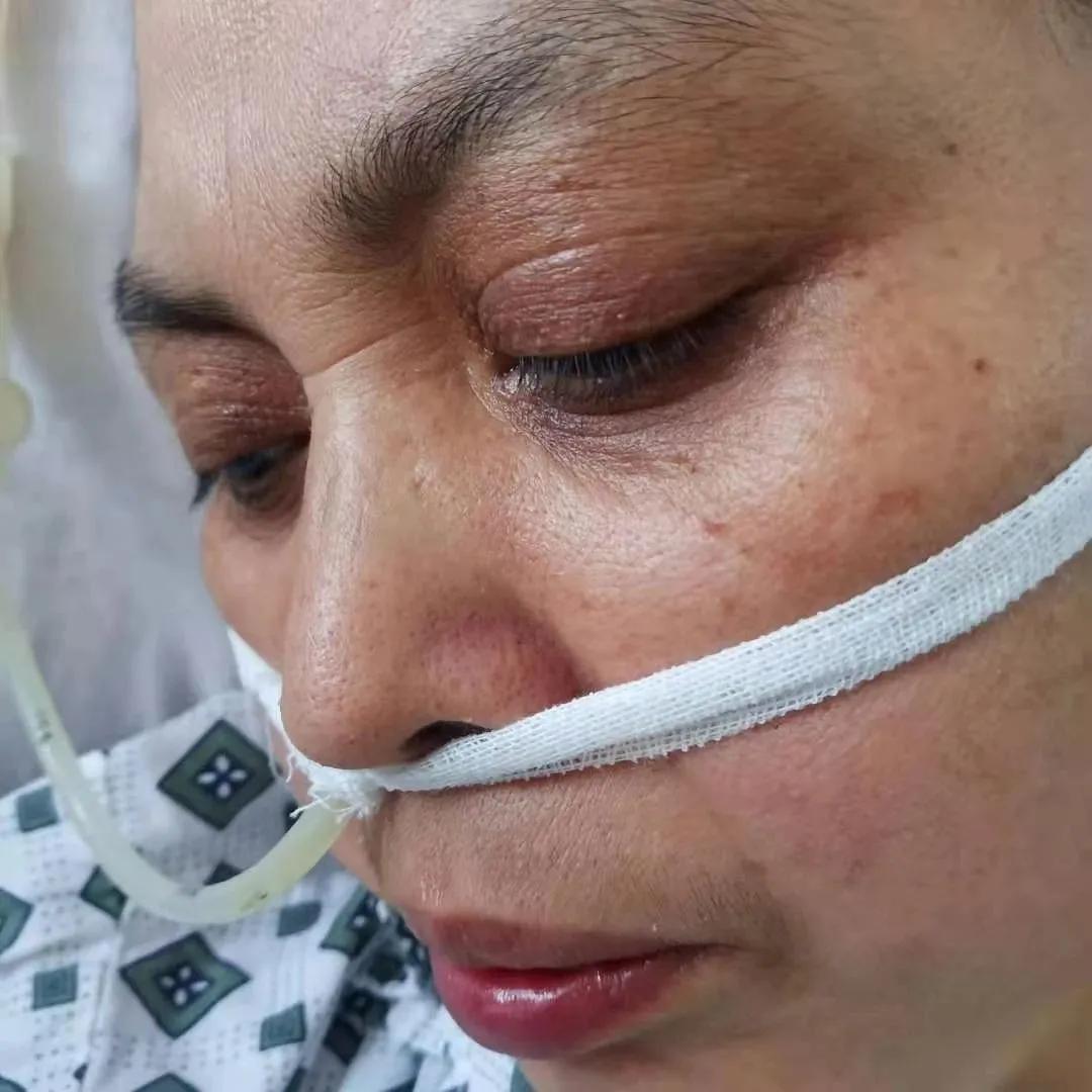 伏羲门故事:一氧化碳中毒后四个月,我终于如获新生了