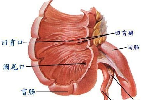 治疗|粪石是什么东西，为什么会跑到阑尾里面去，有生命危险吗？