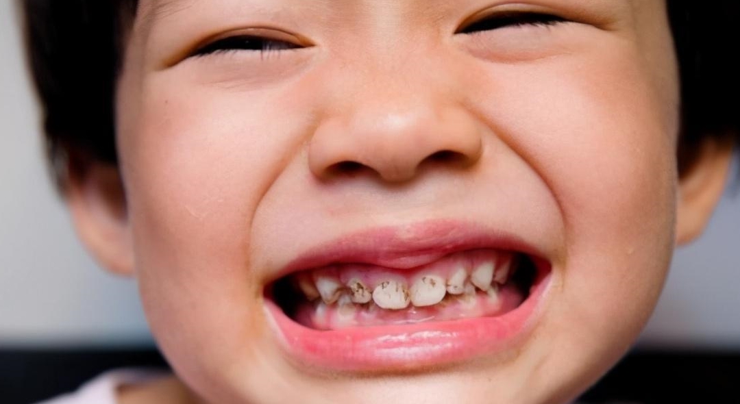 全网最漂亮的宝宝 dd9c656a5844499d9847ed12d55d79cf.jpeg