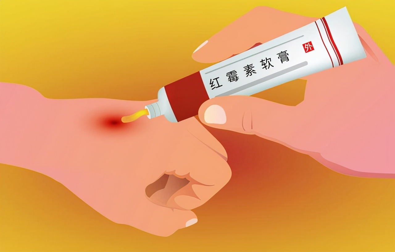 红霉素软膏,在眼部涂两下,会给身体带来什么影响
