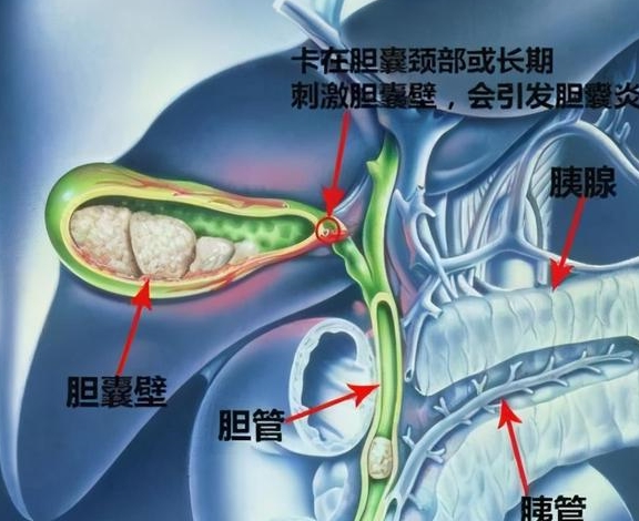 治疗|危机预警：吃一顿大餐，可能会送命？！f