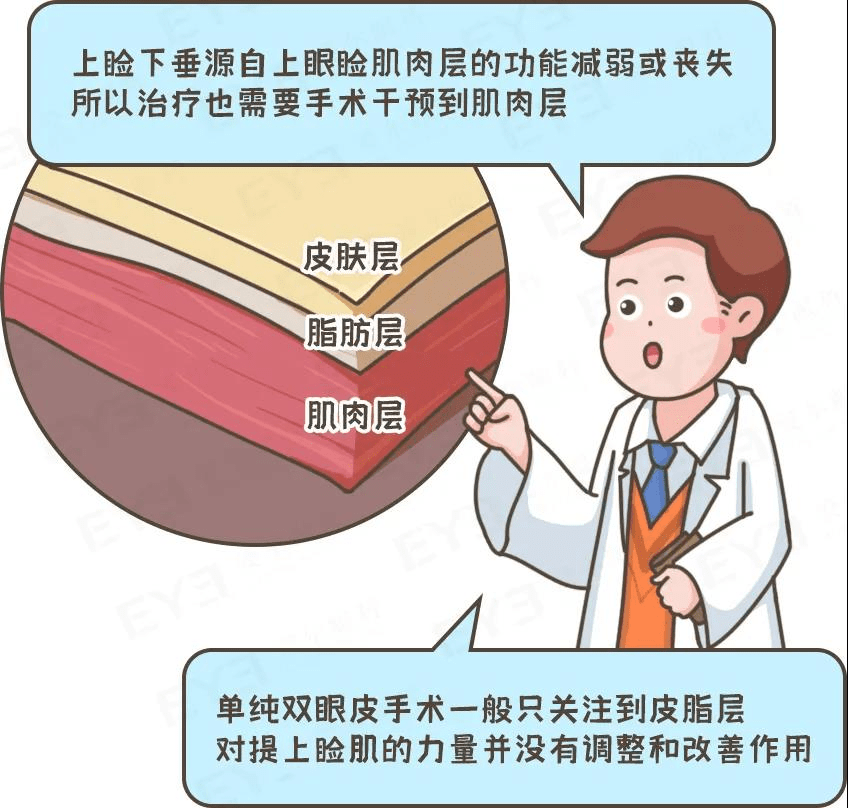 治疗眼睛难以睁开也是一种病？眼科专家：警惕上睑下垂