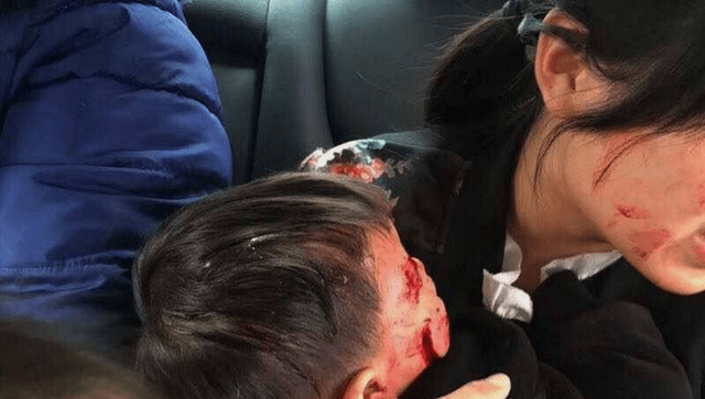 恶犬咬人何时休邯郸13岁男孩惨不忍睹遭4条恶犬围攻仅剩骨头