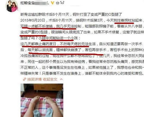 家长花费400多万整容200次的“红粉宝宝”，现状如何？与之前判若两人