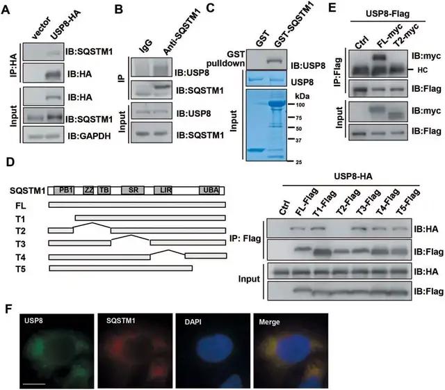 截断式co-ip,免疫荧光共定位等方式,结果都指向usp8与自噬受体sqstm1
