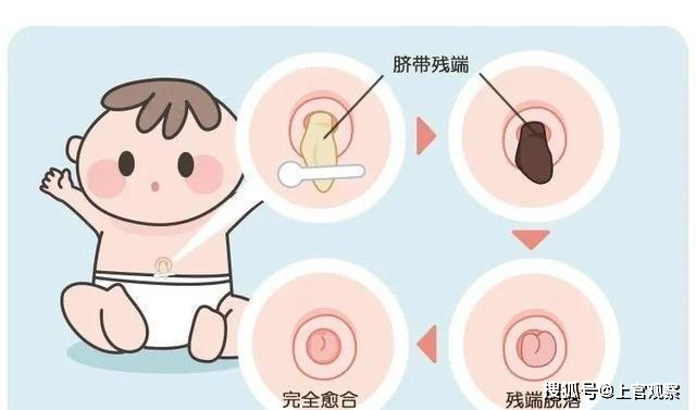 肚脐眼里的"泥"究竟是啥,能不能抠?