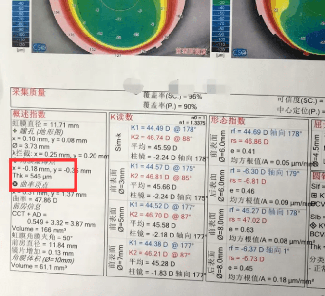 眼科病例单图片图片