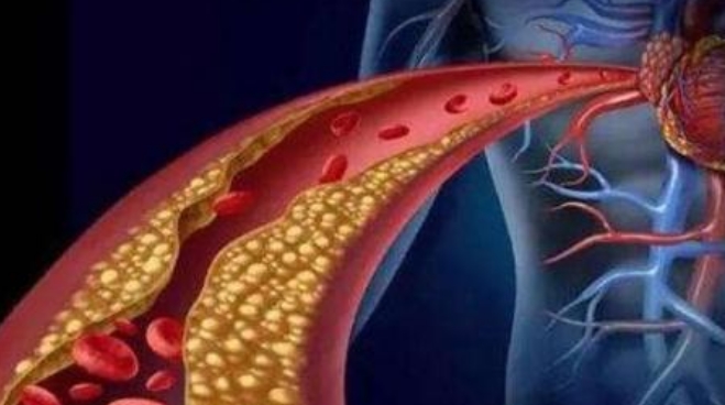 吃什么东西能改善血管弹性 4a454f57149c453881069cd7e0a3f6aa.jpeg