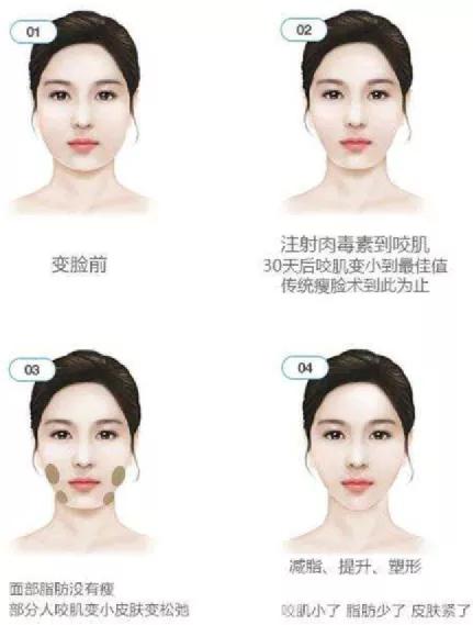 玛吉为什么她会从整形模板翻车成馒化代表？