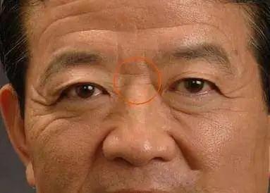 额头有纹的人注意了你的运势正隐藏其中