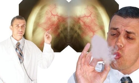 抽烟不过肺有几种方式 fdba3b901a3a44a787be20ece5d919fa.jpeg