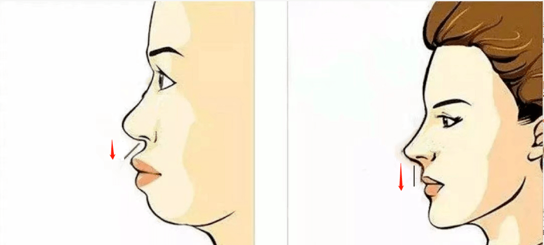 对比鼻基底对面部的影响有多大?