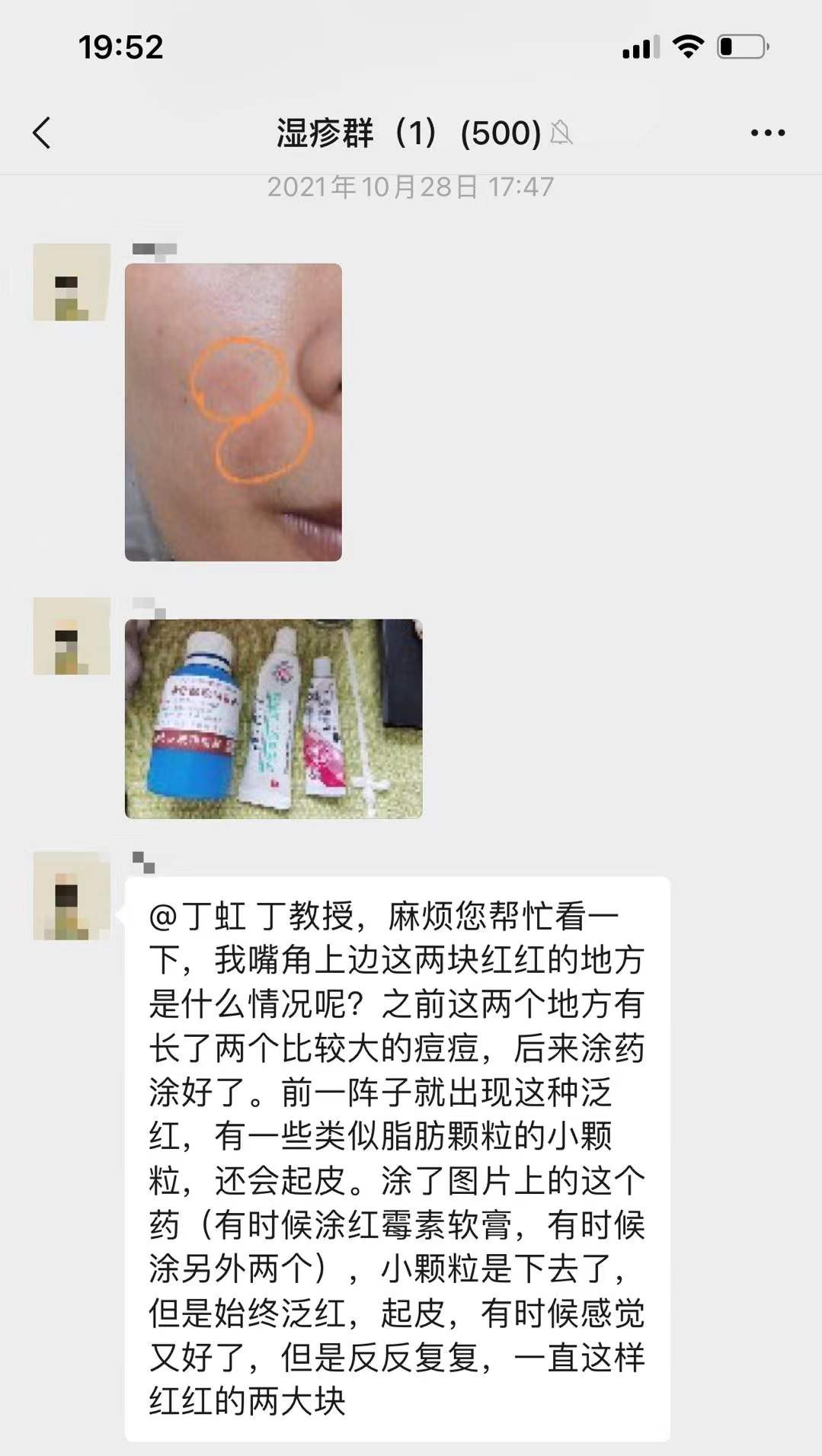 进行嘴角处两个较大痘痘，后来消了，但始终泛红，起皮，应该如何改善？