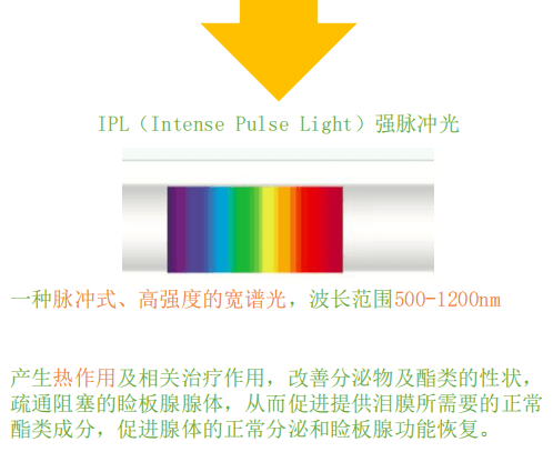 强脉冲光(ipl)疗法治疗干眼症?