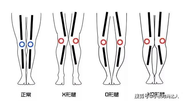 脚踝 腿型有这5种特征的女人，千万别再乱穿靴子，不但显腿粗还老气