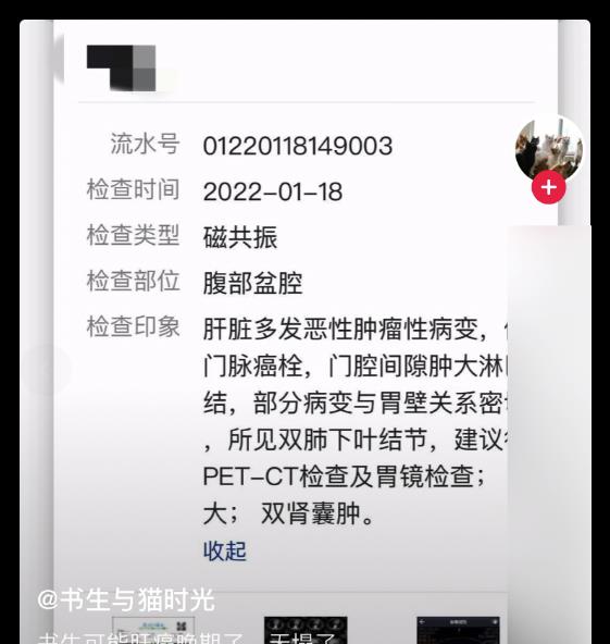 知名网红因肝癌晚期去世,将无偿捐献遗体,上个月还在众筹医药费