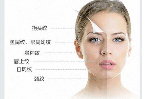 驚川字紋除皺針的危害和副作用是真的有嗎打除皺針多久有效果