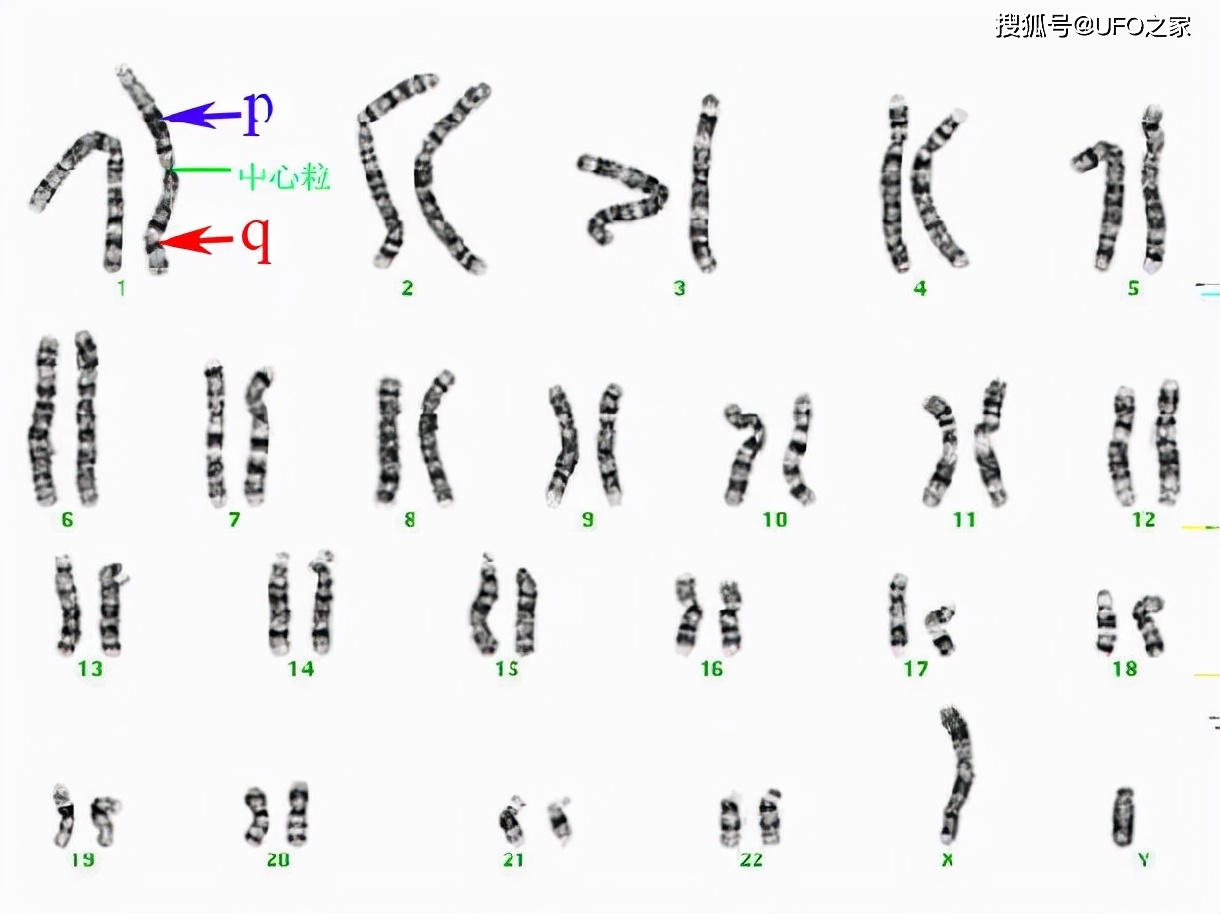 人类中的特例