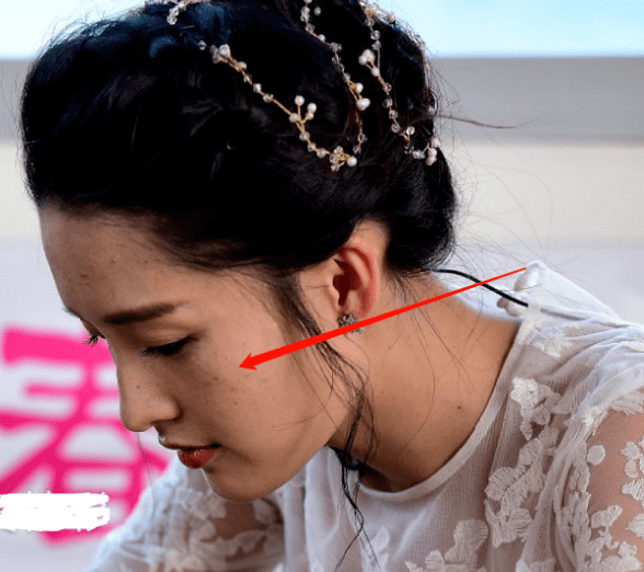 高清生浮粉、长痘、整容痕迹，明星未修图里的脸，让我看见了人间真实