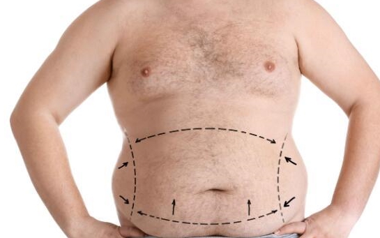 消耗|糖尿病患者，为何消瘦？医生坦言：致瘦的5大因素，要了解