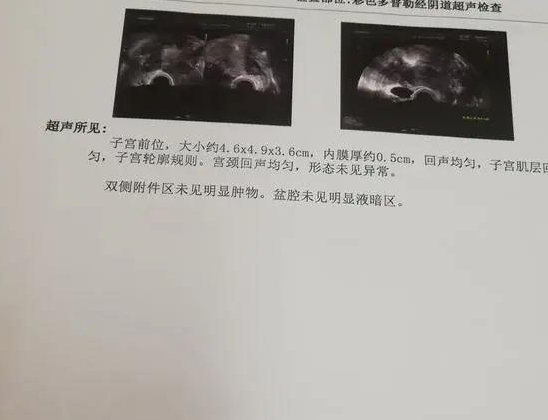 cfbce1eb429d4ba4a961f4809d4b7bc0.jpeg