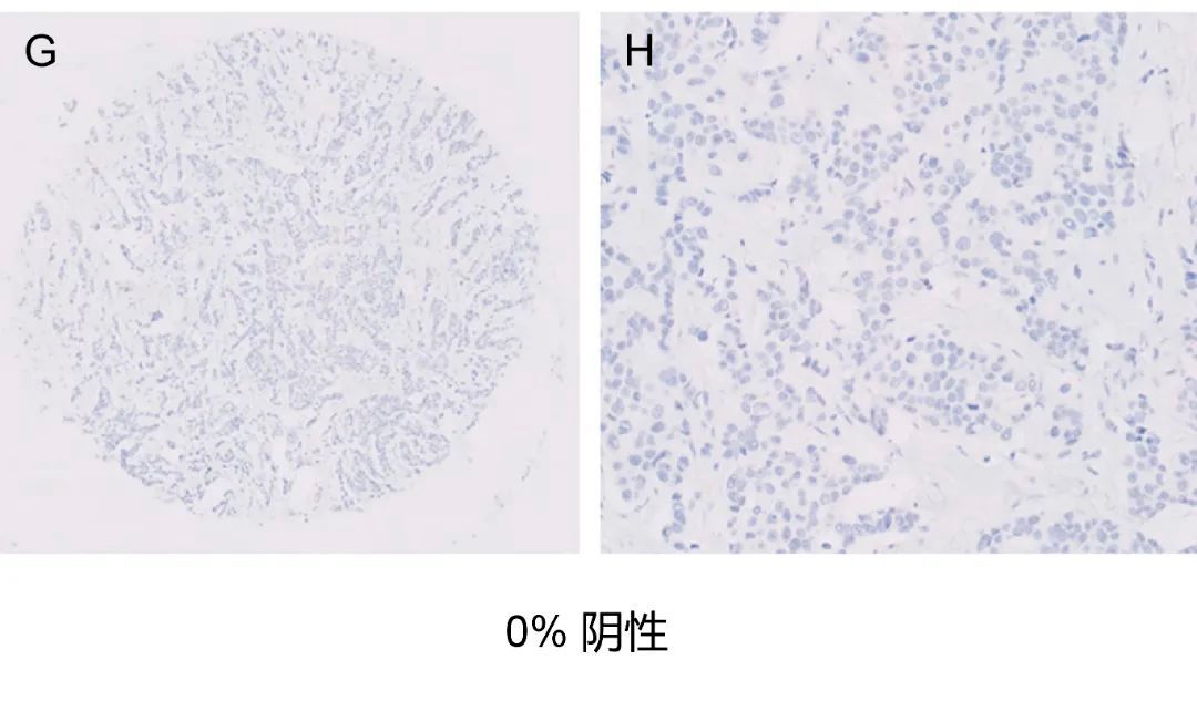 指南规范2021年最新乳腺癌雌激素受体er免疫组织化学检测