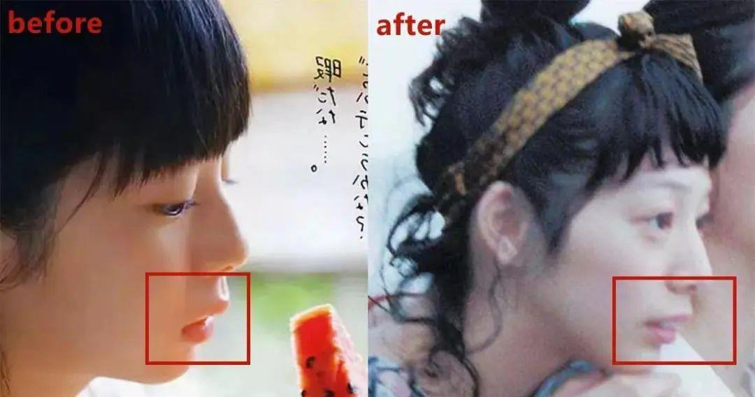 小天关晓彤是不是do脸了？凹脸变得幼态又平整