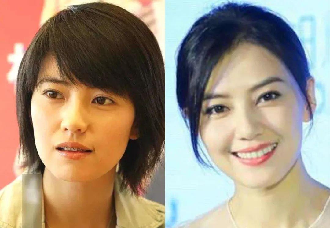 小天关晓彤是不是do脸了？凹脸变得幼态又平整
