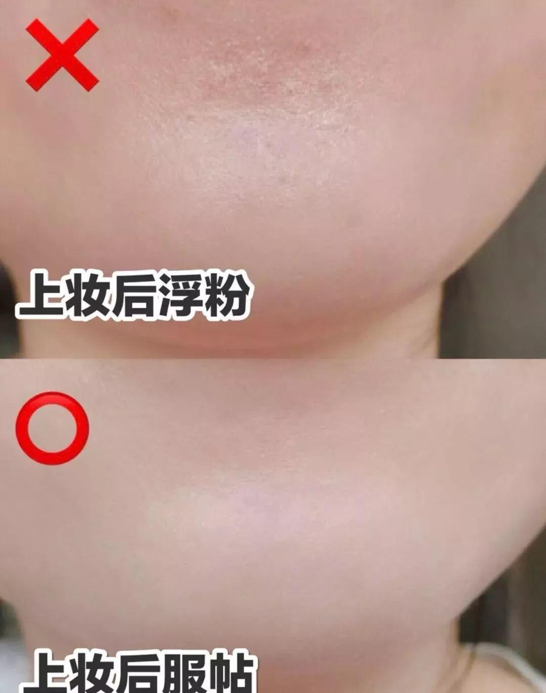 兰蔻好爽肤水倒手上就开始拍？医生哭笑不得：果然是人傻钱多！