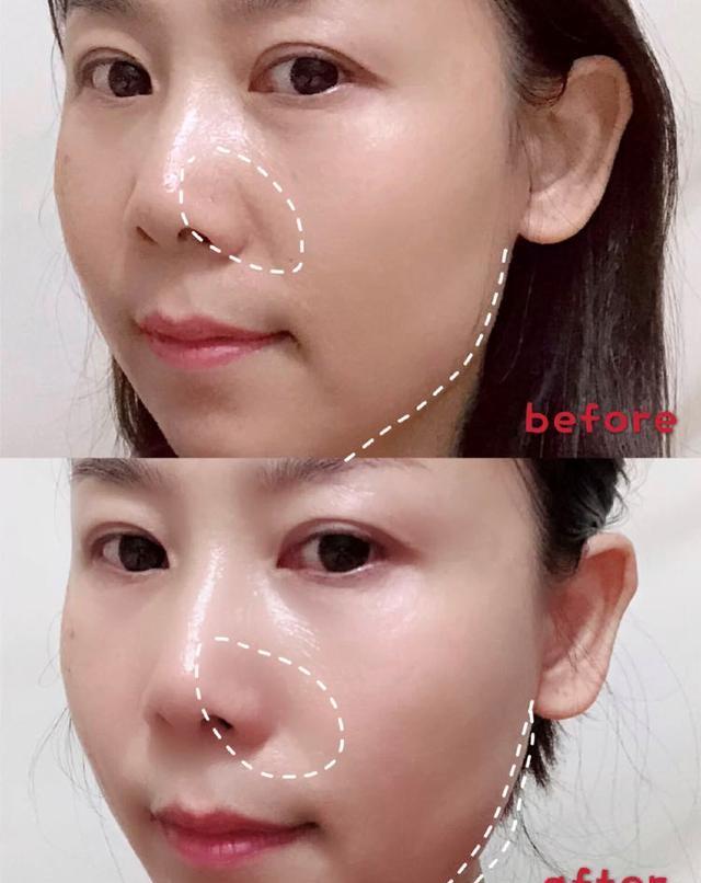 化妆品59岁英国女子靠“整容”抗老，连续抽脂30多次，现在怎么样了