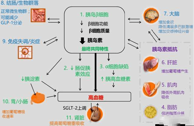 治疗|糖尿病人必须清楚的事实：比用药更好的就饮食治疗！