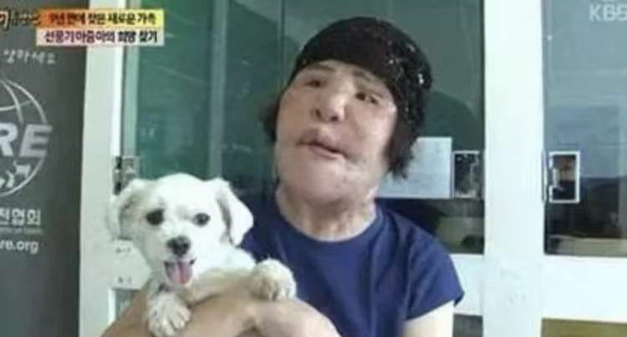 因为女星韩慧景：为了更漂亮，给脸注射食用油，把脸整成“猪头”