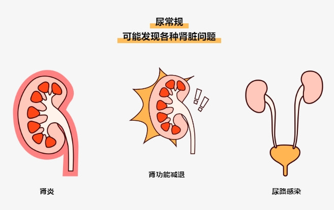 易加医带你涨知识:尿常规结果居然能看出这么多问题!