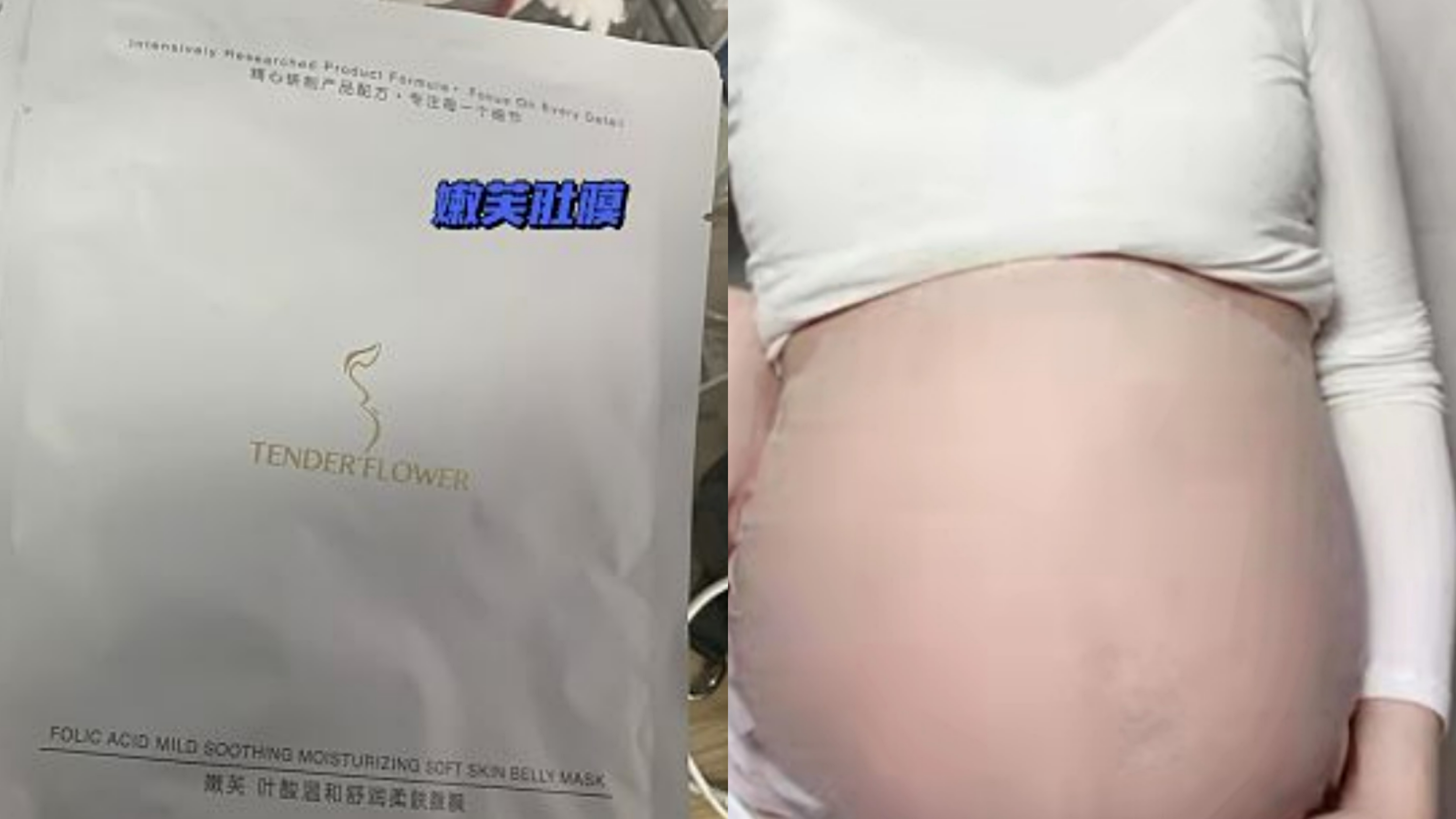 控制|孕期涂橄榄油可以预防妊娠纹？别傻了，防治妊娠纹，试试这3招